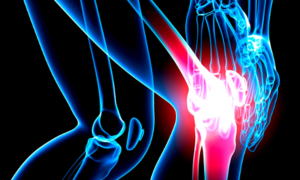 La artrosis - Principal enfermedad crónica entre las mujeres