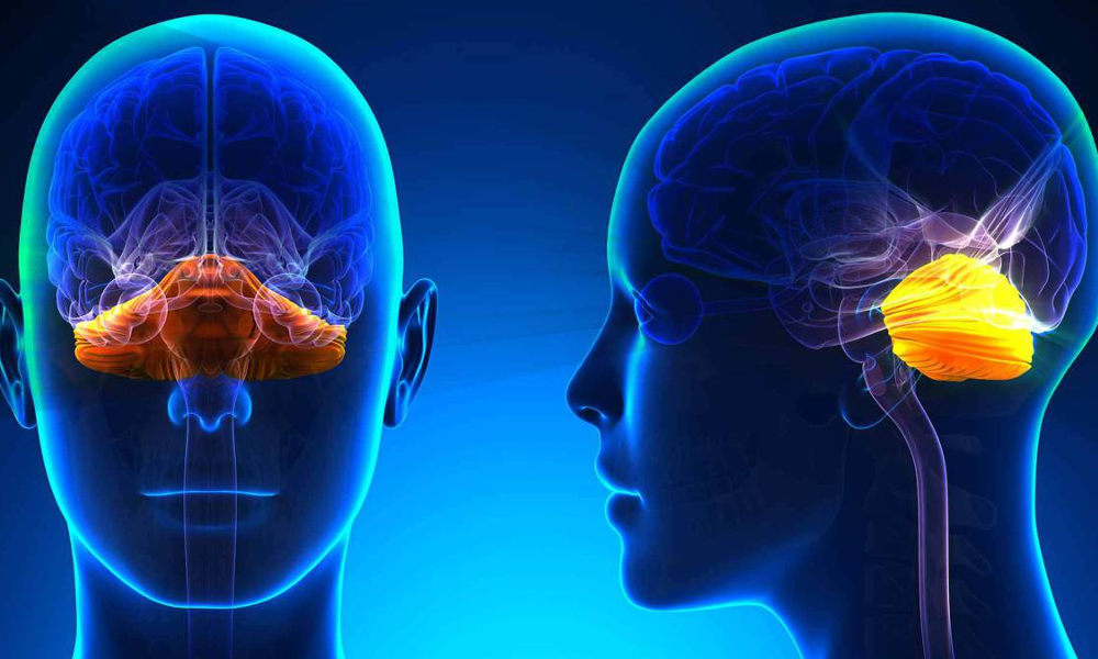 Ataxia - No identificado el gen causante en mitad de los casos