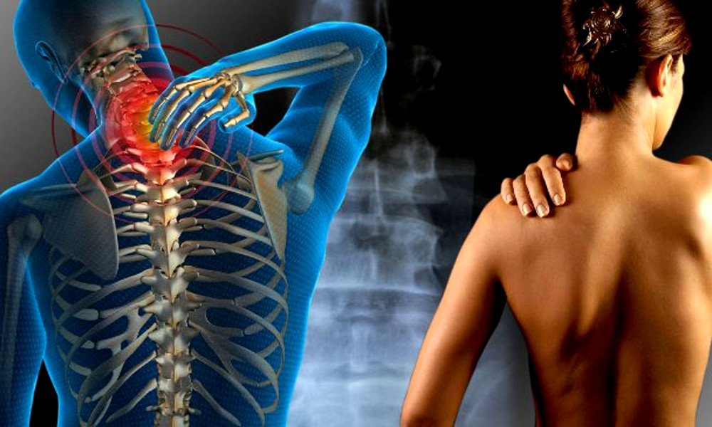 Fibromialgia y Fatiga crónica - La padecen mas las mujeres