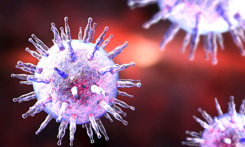 Esclerosis múltiple y enfermedad del beso