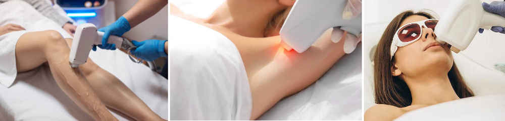 Técnicas de depilación femenina - Cera, cremas, cuchilla, láser...